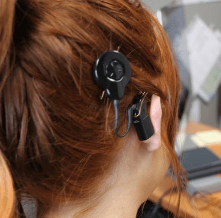 Cochlear Implants Hearing Aids